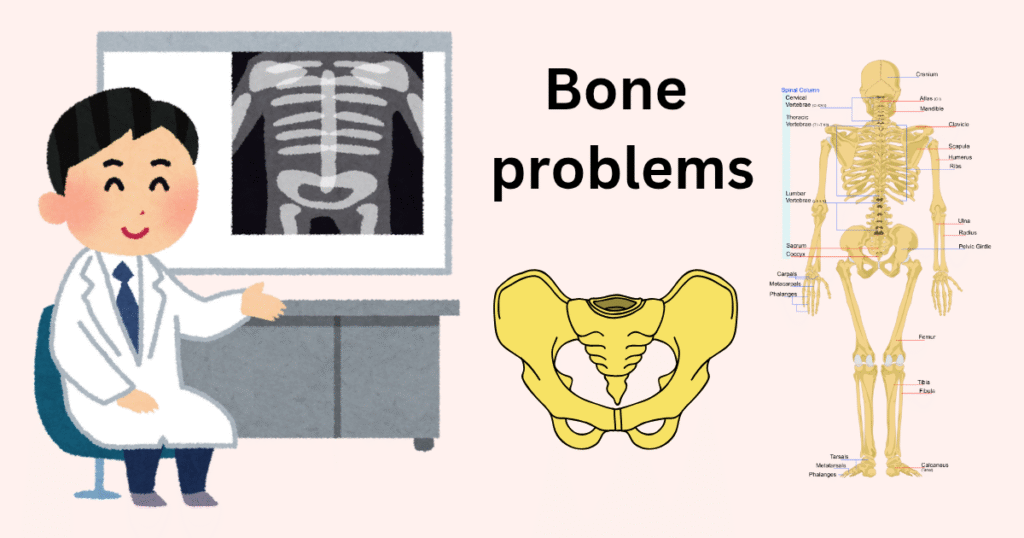 bone probles